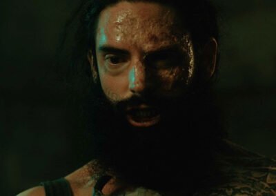 scars04-400x284