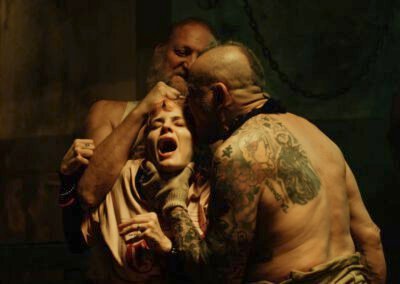 scars05-400x284